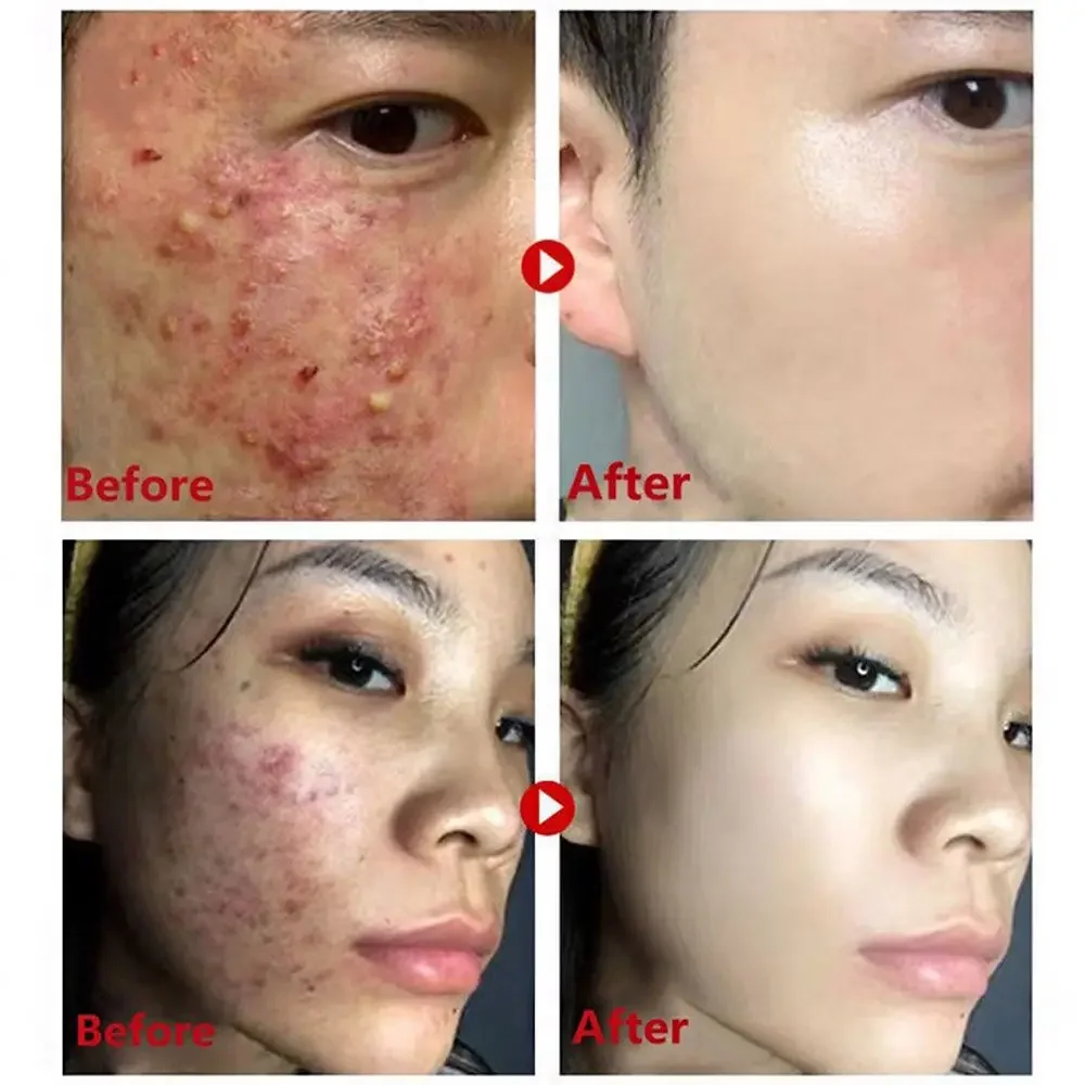 Green Tea Mask Stick Remove Bl - Green Tea Cleansing Clay Mask recension och pris