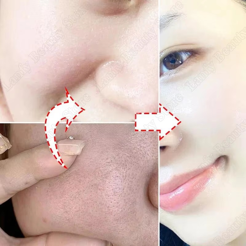 Salicylic Acid Pore Clearing C - Salicylic Acid Blackhead Remover recension och pris