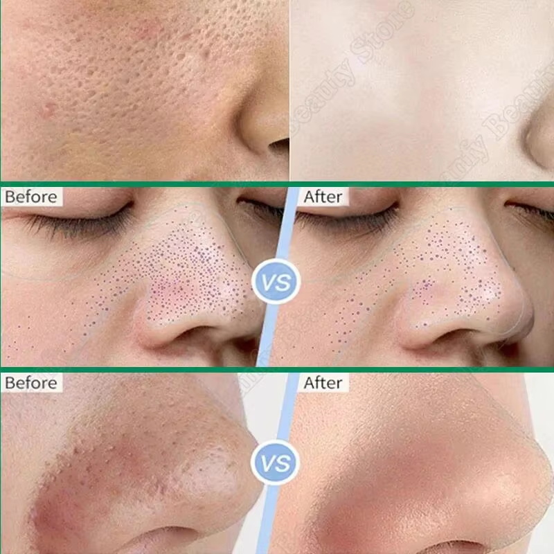 Salicylic Acid Pore Clearing C - Salicylic Acid Blackhead Remover recension och pris