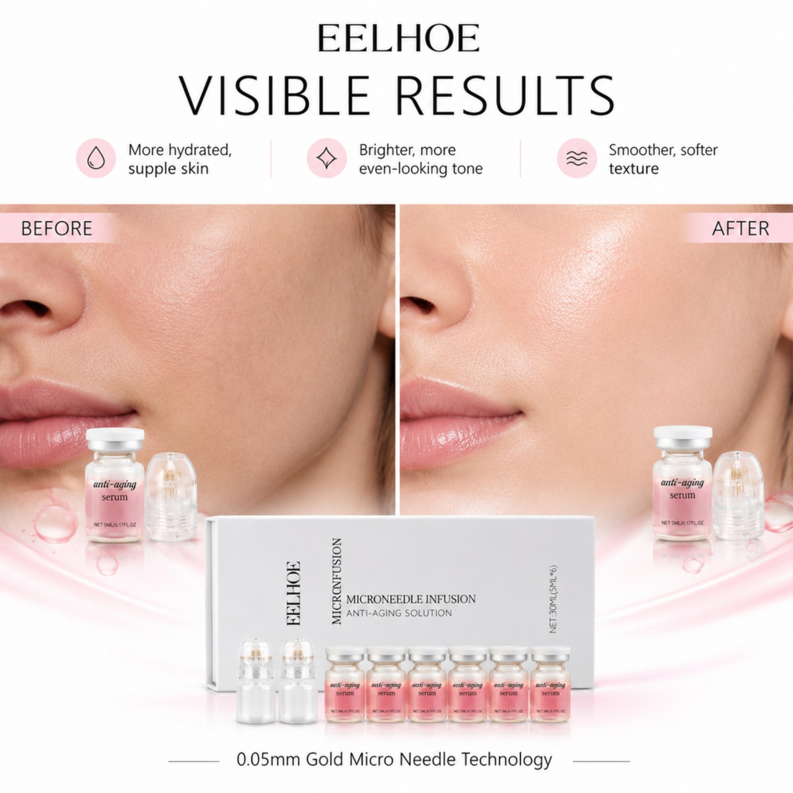 0.2mm Microneedle Serum Kit 6  - Hyaluronic Acid Facial Serum recension och pris